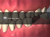 Did You Know Bridges video thumbnail image